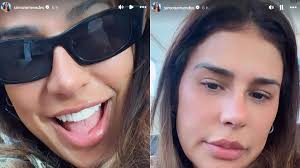 Simone Mendes revela reação do marido ao vê-la após procedimento no nariz
