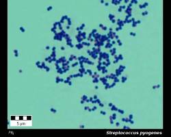 Imagem de Streptococcus pyogenes bacteria under a microscope