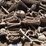  Oldest evidence of HBV found in 4500-year-old human remains