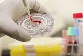 Image result for photos showing vaccines being tested on monkeys