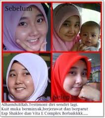 Image result for testimoni esp shaklee untuk kulit