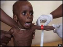 anak kurang gizi. MSF mengatakan tingkat kematian di kamp mencapai 5 persen pertahun. - _41360595_malnourishedap