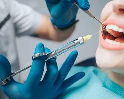 Image of Dental anesthesia