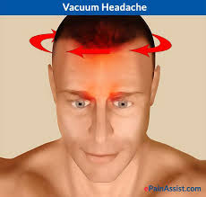 Kết quả hình ảnh cho headache