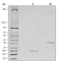 Preparation of recombinant human GDNF by baculovirus expression