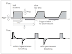 Bipap assist