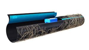Preventing Root Intrusion In Wastewater Drip Systems | Anua