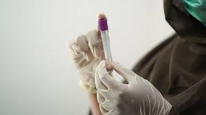 Trend Google: meningite meningococcica
