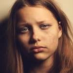  Depression Striking More Young People Than Ever