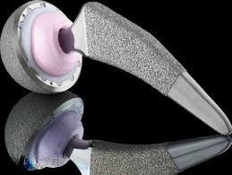 Surgical Technique Guide