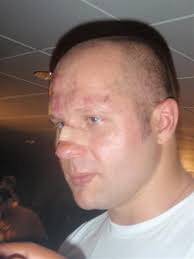 Fedor post-fight: Brett Rogers and the damage done - Fedor%25201%2520(Medium)