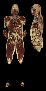 Image result for visible human project