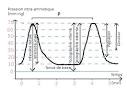 Contractions de travail