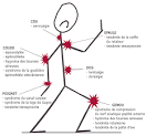 Les trouble musculo squelettiques