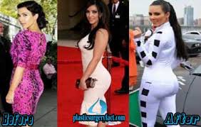 Résultat de recherche d'images pour "who is kim kardashian before and after"