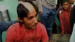 Man's Hair Shaved Allegedly Posting