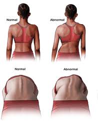Afbeeldingsresultaat voor afbeelding cobbse hoek