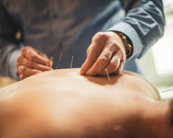 Imagen de person receiving acupuncture treatment