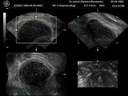 Znalezione obrazy dla zapytania Cysta
