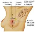 Merkmale von gutartigen und bösartigen Knoten