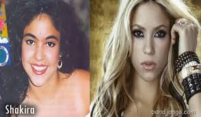 Resultado de imagem para antes e depois dos famosos