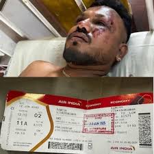 Milagro en India: Un Sobreviviente Tras el Impactante Accidente Aéreo - Imagen ilustrativa del artículo