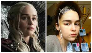 Emilia Clarke revela ter congelado óvulos após hemorragias cerebrais durante produção de 'Game of Thrones'