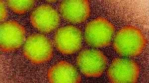 Deadly disease not seen in Australia for nearly 20 years detected in wastewater in Perth