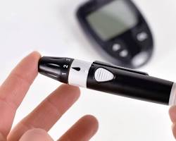 Image of Glucometer lancet device