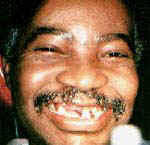 Resultado de imagen para ugly boobs