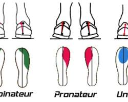 Image de Pied supinateur