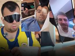 Sözcü - News update