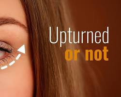 Image of upturned eyes