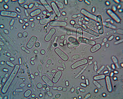 Imagem de Microbes under microscope