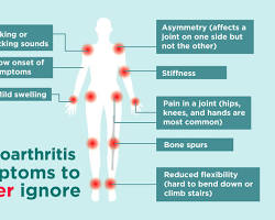 Image of Osteoarthritis in joints