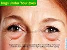 Bags Under Your Eyes? Pictures of 11 Healthy Ways to Get Rid of