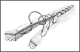 Image result for simple continuous suture pattern