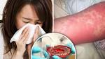  Urgent health warning as Scarlet fever cases DOUBLE across UK