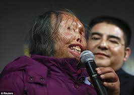 Protest: Hao Huijun and her daughter Chen Guo, set themselves on fire to protest the Chinese government¿s brutal crackdown on Falun Gong practitioners - article-0-1A7A3CED00000578-172_634x453