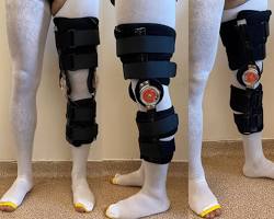 Image of Rehabilitative knee brace