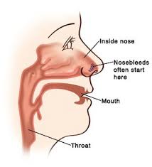 Image result for nosebleed