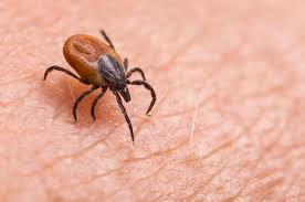 Tick Bite Prevention: Expert Advice for the Sizzling Summer Season - 3