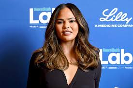 Chrissy Teigen Reveals Hairline Lowering Procedure