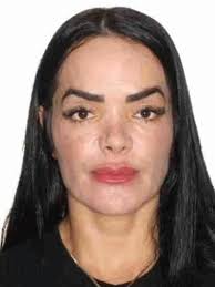 Maquiadora morre após remodelação com PMMA em SP; médica usou 100 seringas