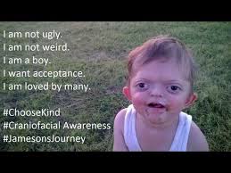 Image result for welcome to the internet meme