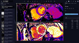 Diagnostic Imaging - News update