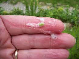 Image result for spittle bug