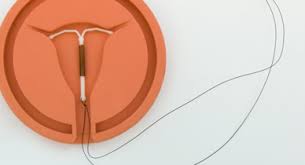 Image result for IUD image