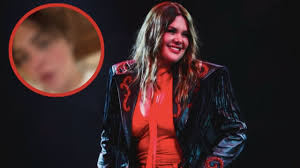 ¿Yuridia se quemó el rostro? este es su estado de salud tras pedir ayuda en redes sociales | VIDEO