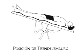 Resultado de imagen de posicion decubito Trendelemburg